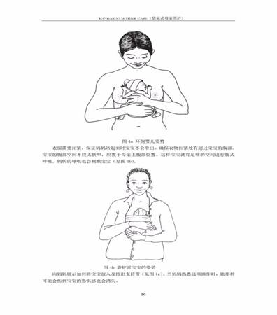 袋鼠式护理姿势