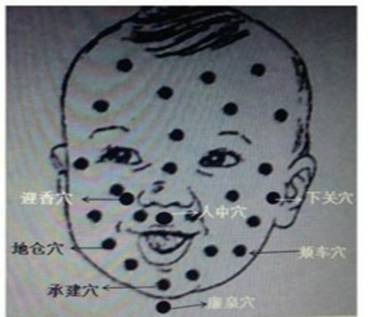 面部