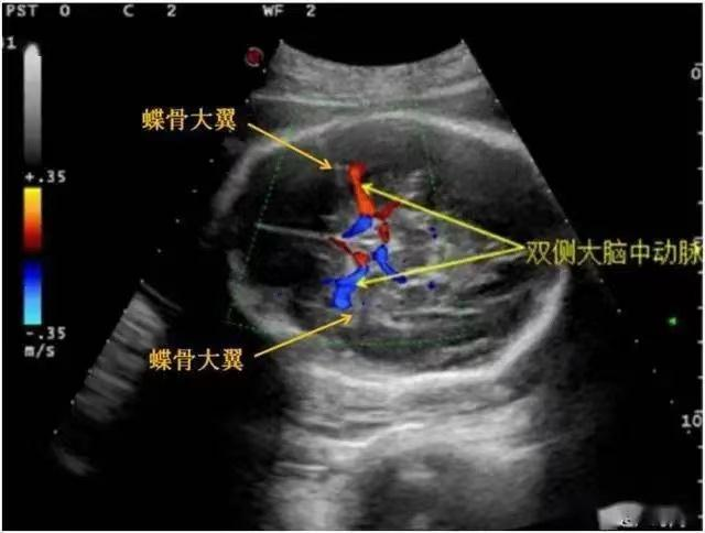 图片 3