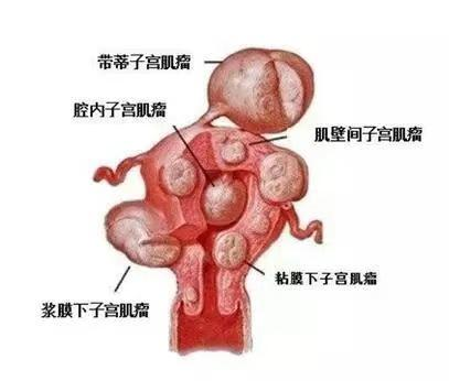 图片 4