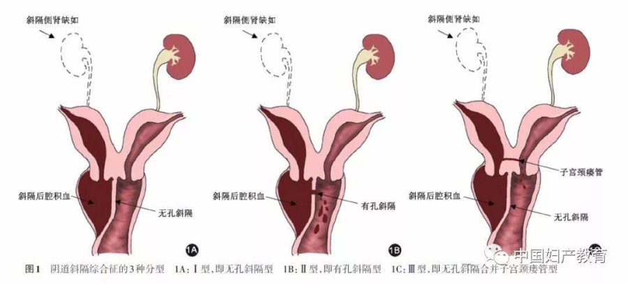 图片 1