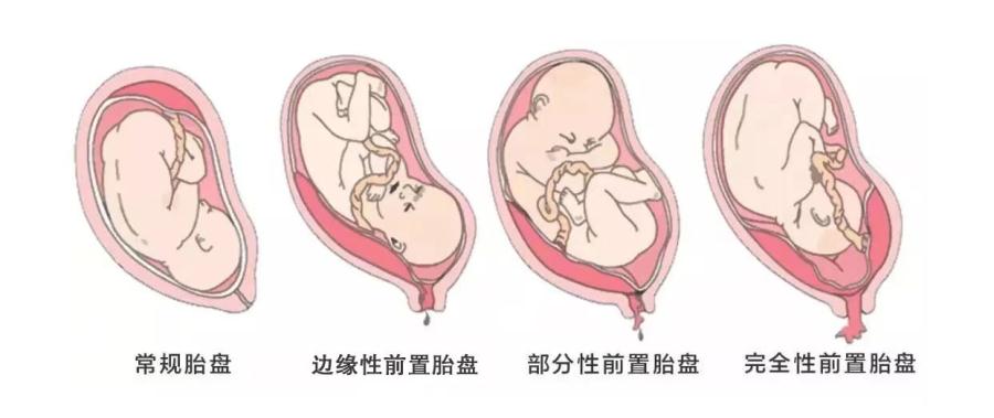图像1