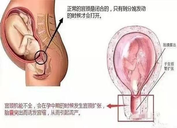 cef80ba43c4c376ab7f438430196fe23