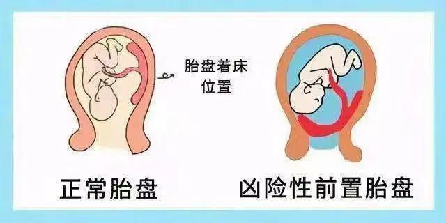 凶险性