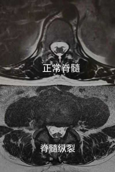 Image1
