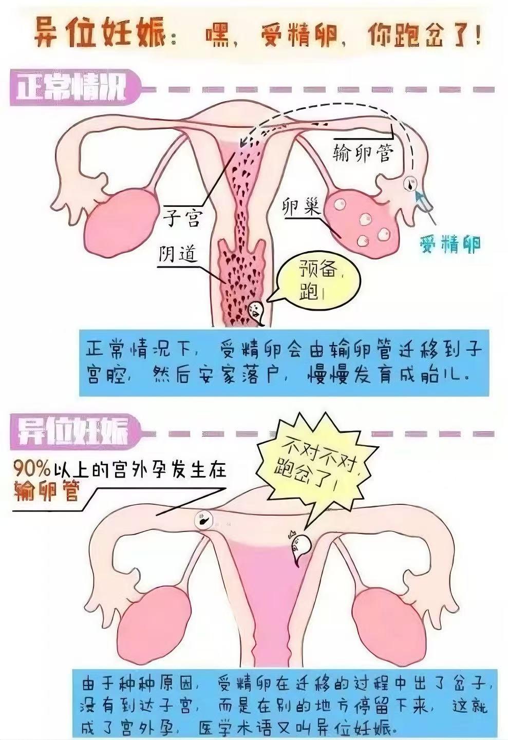 b3667d746df00ae485afeb796a3a645